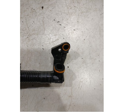 Вентиляционная трубка