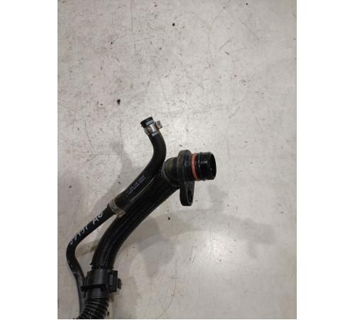 Вентиляционная трубка